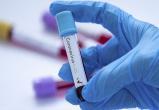 В Югре выявлен 5-й случай коронавируса